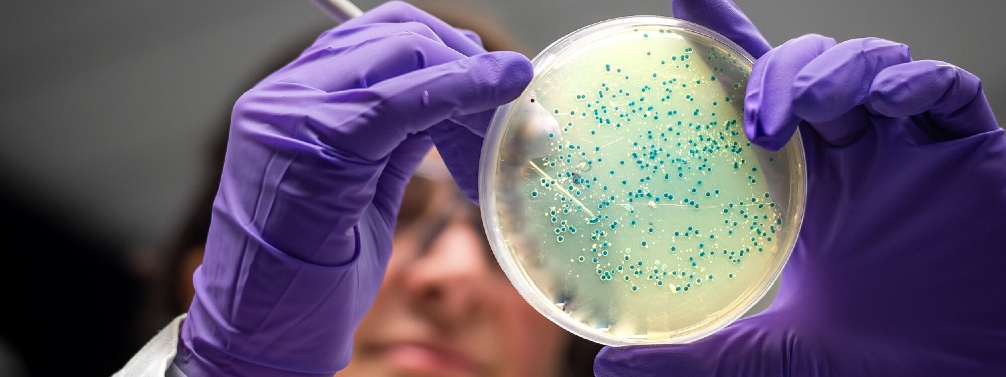 Microbiome research in microbiology laboratory 2021 08 31 12 23 37 utc